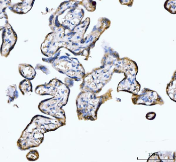 PDE4DIP Antibody