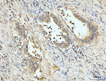 PDLIM7 Rabbit Polyclonal Antibody