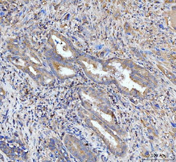PDLIM7 Rabbit Polyclonal Antibody