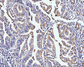 PDLIM7 Rabbit Polyclonal Antibody