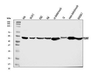 PDLIM7 Rabbit Polyclonal Antibody