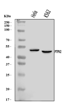 TCPTP/PTPN2 Rabbit Polyclonal Antibody