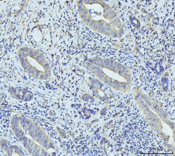 RPL23 Antibody