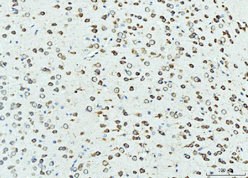 RPL23 Antibody