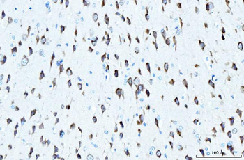 RPL23 Antibody
