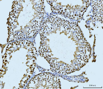 SBNO1 Antibody