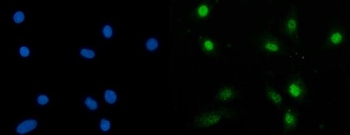 SBNO1 Antibody