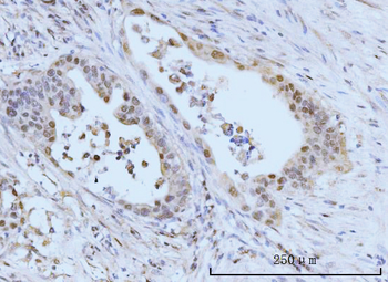 SBNO1 Antibody