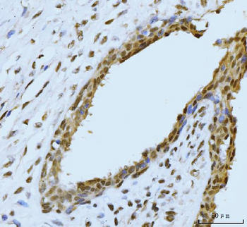 SBNO1 Antibody