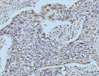 SBNO1 Antibody