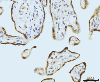 SBNO1 Antibody