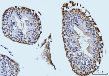 SBNO1 Antibody