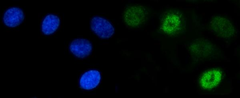 SCP3/SYCP3 Rabbit Polyclonal Antibody