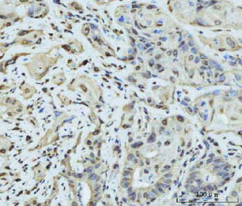 SCP3/SYCP3 Rabbit Polyclonal Antibody