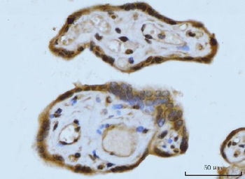 SCP3/SYCP3 Rabbit Polyclonal Antibody