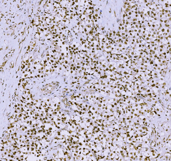 SCP3/SYCP3 Rabbit Polyclonal Antibody