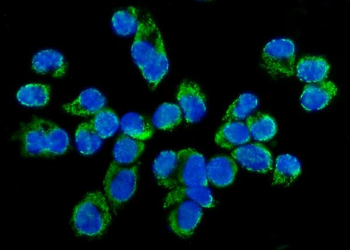 TARS2 Rabbit Polyclonal Antibody