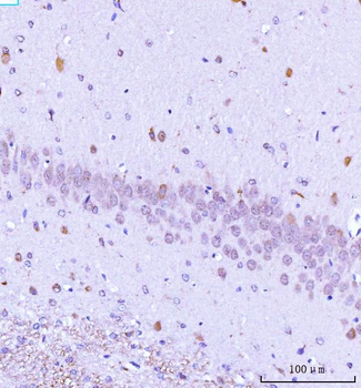 TARS2 Rabbit Polyclonal Antibody