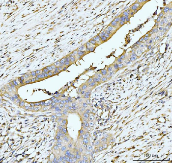 hUPF2/RENT2/UPF2 Rabbit Polyclonal Antibody