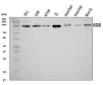 VLDL Receptor/VLDLR Rabbit Polyclonal Antibody