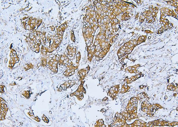 Filamin B/FLNB Antibody