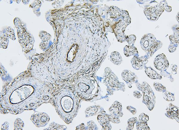 Filamin B/FLNB Antibody