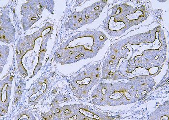 Filamin B/FLNB Antibody