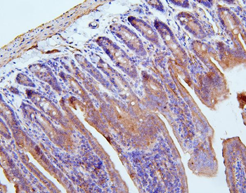 Filamin B/FLNB Antibody