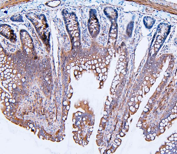Filamin B/FLNB Antibody