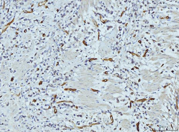 FABP4 Antibody (monoclonal, 10E12)