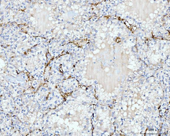 FABP4 Antibody (monoclonal, 10E12)