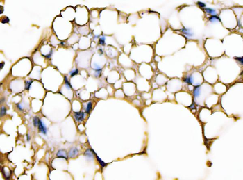 FABP4 Antibody (monoclonal, 10E12)