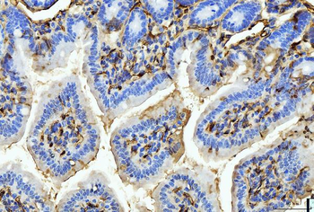 FABP4 Antibody (monoclonal, 10E12)