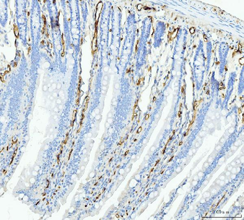FABP4 Antibody (monoclonal, 10E12)