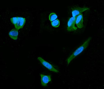 PDE6 beta/PDE6B Mouse Monoclonal Antibody