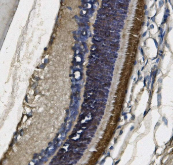 PDE6 beta/PDE6B Mouse Monoclonal Antibody