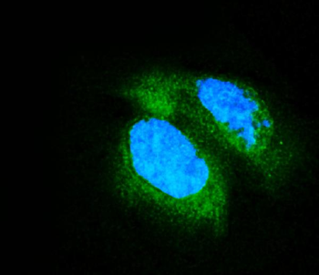 PDE6 beta/PDE6B Mouse Monoclonal Antibody