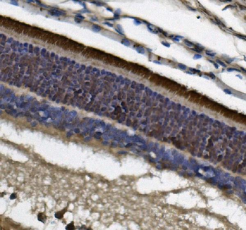 PDE6 beta/PDE6B Mouse Monoclonal Antibody
