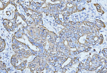 Cytokeratin 5 Antibody (monoclonal, 9H2F8)