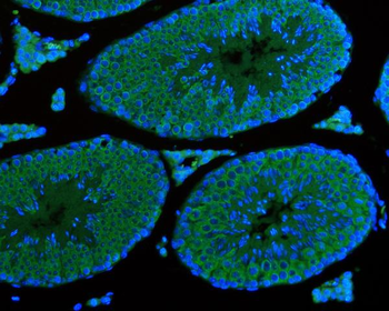 DDX4/MVH Mouse Monoclonal Antibody