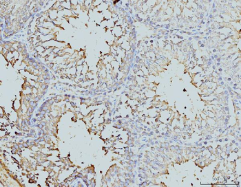 DDX4/MVH Mouse Monoclonal Antibody