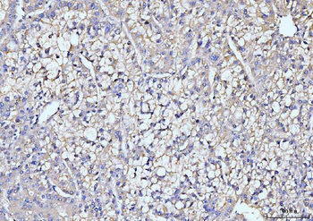 ITCH/AIP4 Antibody (monoclonal, 5E12)