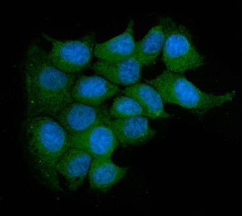 Acid phosphatase/ACP5 Rabbit Polyclonal Antibody