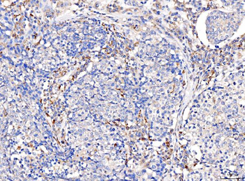 Acid phosphatase/ACP5 Rabbit Polyclonal Antibody