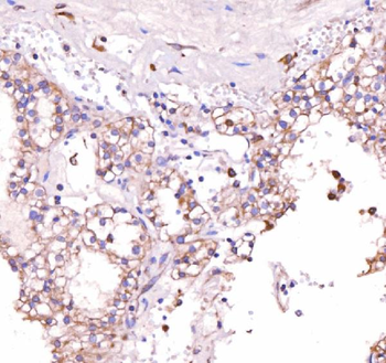 Acid phosphatase/ACP5 Rabbit Polyclonal Antibody