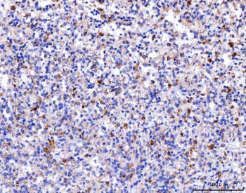 Acid phosphatase/ACP5 Rabbit Polyclonal Antibody