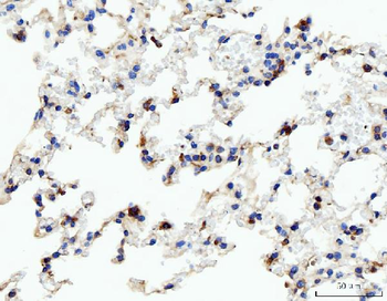 Acid phosphatase/ACP5 Rabbit Polyclonal Antibody