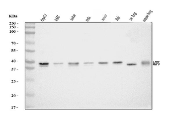 Acid phosphatase/ACP5 Rabbit Polyclonal Antibody