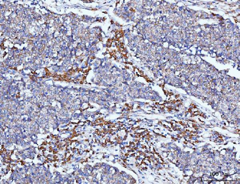 PACAP-38/ADCYAP1 Antibody
