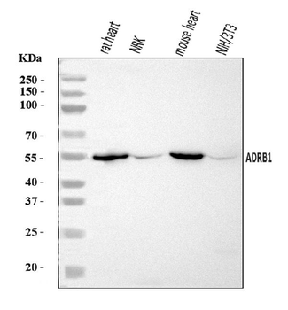 ADRB1 Rabbit Polyclonal Antibody